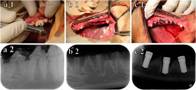 A comparative study of Sr-loaded nano-textured Ti and TiO2 nanotube implants on osseointegration immediately after tooth extraction in Beagle dogs